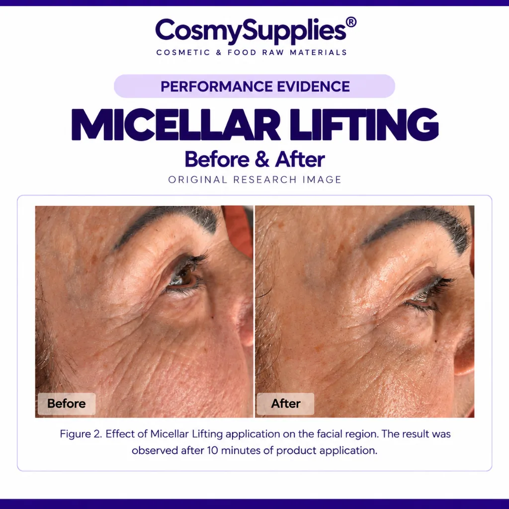 Micellar Lifting Before & After3rd try.webp